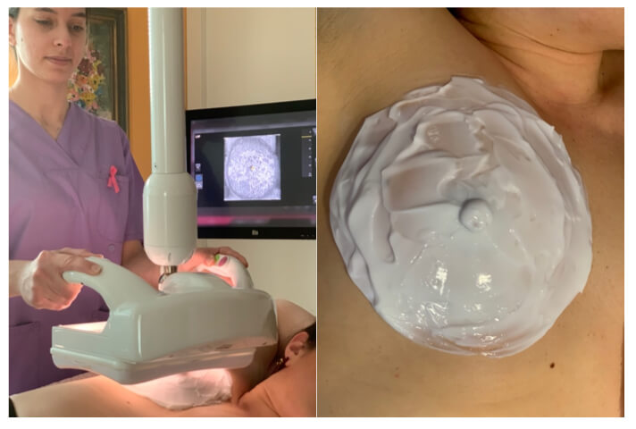 img 01 02 uperixo grafima mastou